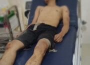 Warga Medan Tembung Nyaris Tewas Dihajar Massa Di Deli Serdang