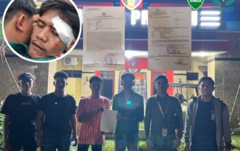 Buntut Aksi Berdarah di Mapolrestabes Medan, Dua Mahasiswa ‘Seret’ Oknum Polisi ke Jalur Hukum