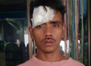 Jagoan Mabuk Membabi Buta, Buruh Harian Dianiaya Hingga Wajah Hancur dan Gigi Rontok!