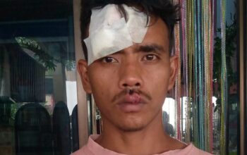 Jagoan Mabuk Membabi Buta, Buruh Harian Dianiaya Hingga Wajah Hancur dan Gigi Rontok!