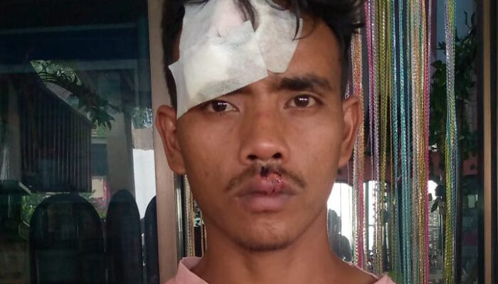 Jagoan Mabuk Membabi Buta, Buruh Harian Dianiaya Hingga Wajah Hancur dan Gigi Rontok!