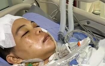 Impian Berubah Jadi Derita: Kisah Pilu Pasutri Medan, Istri Koma di ICU Thailand, Suami Berharap Uluran Tangan